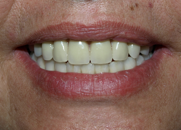 Emfyteymata ano meta 4