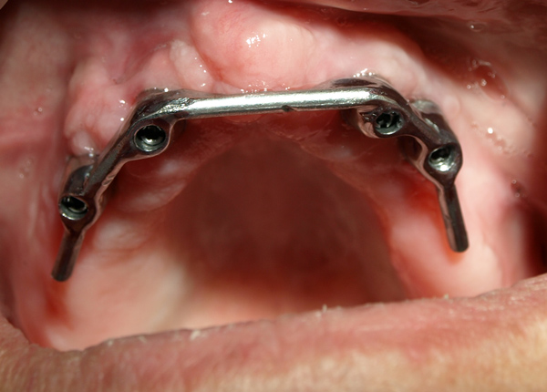 Emfyteymata ano prin 4