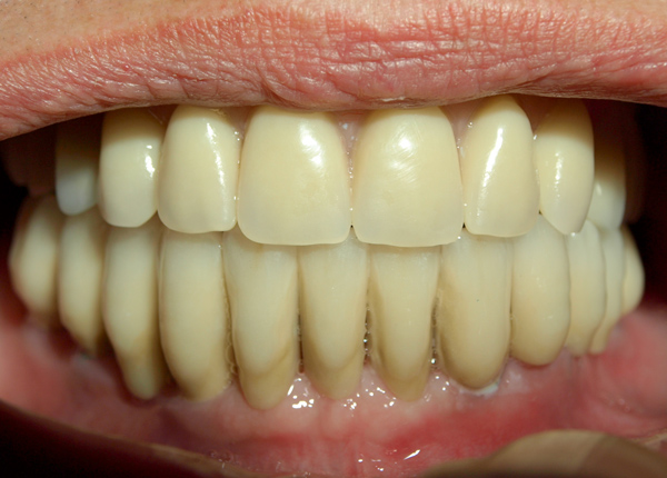 Emfyteymata kato meta 4