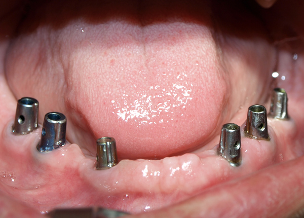 Emfyteymata prin kato 4