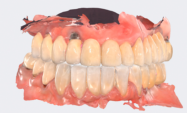 dental-praxis-psifiaka-kathodigoumeni-1