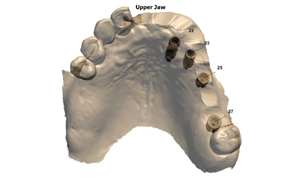 dental-praxis-psifiaka-kathodigoumeni-3