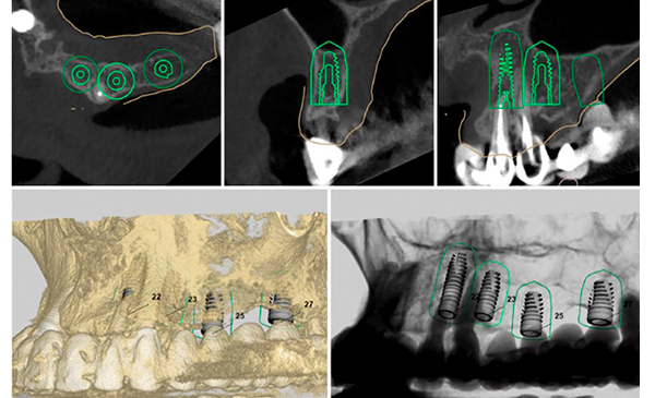 dental-praxis-psifiaka-kathodigoumeni-4