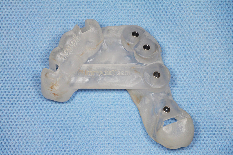 dental-praxis-psifiaka-kathodigoumeni-5