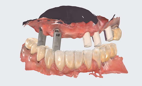 dental-praxis-psifiaka-kathodigoumeni-6