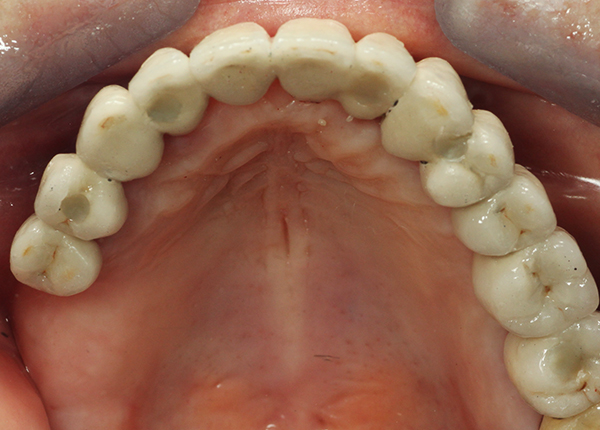 dental-praxis-psifiaka-kathodigoumeni-8